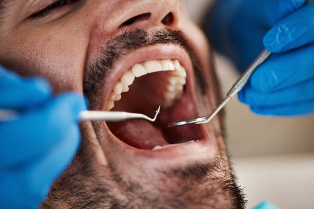 Best Emergency Dental Services for Seniors in Hillsborough, NC