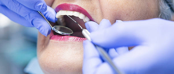 Best Broken or Cracked Tooth Emergency Dentist in Hillsborough, NC